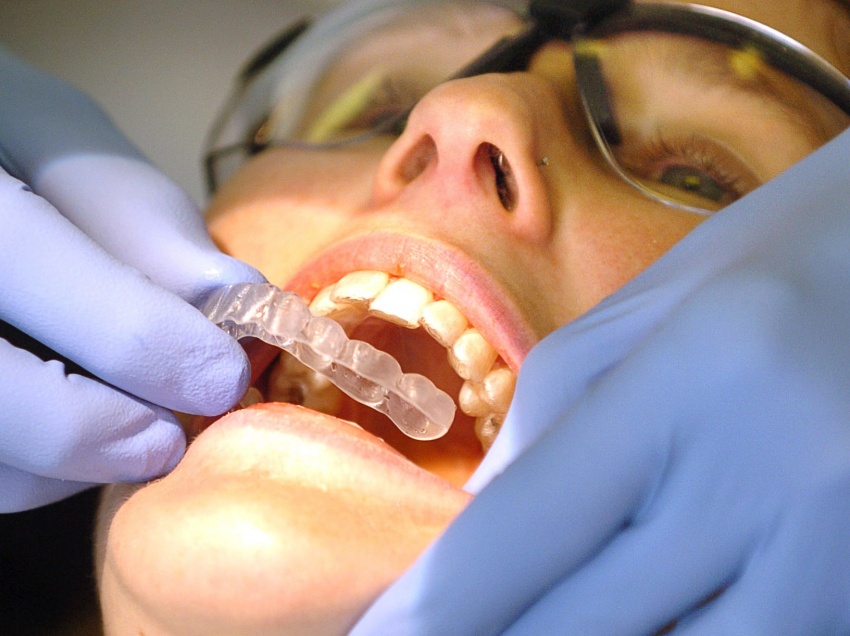 GP: Align Technology Invisalign